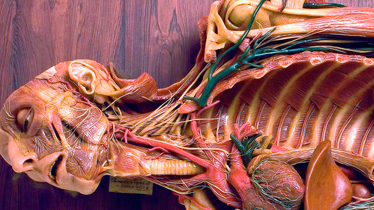 Testa, tronco e arto superiore sinistro di uomo con preparazione di nervi e vasi