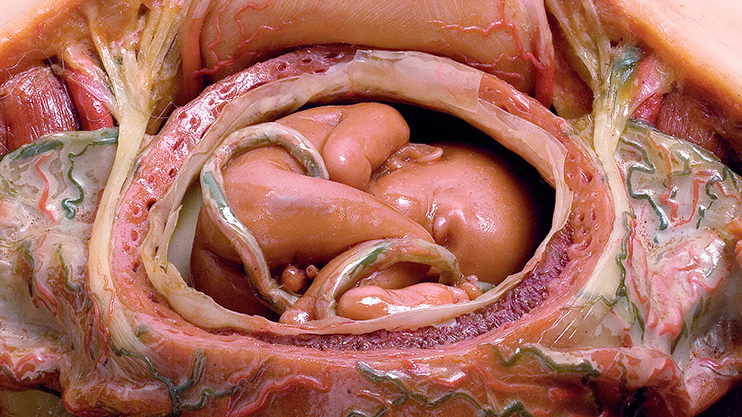 Female uro-genital system with opened uterus during pregnancy